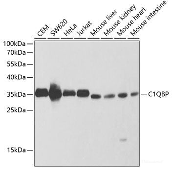 Immunofluorescence analysis of MCF-7 cells using CDKN3 Polyclonal Antibody