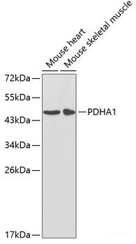Western blot analysis of extracts of various cell lines using EEF2 Polyclonal Antibody at dilution of 1:500.