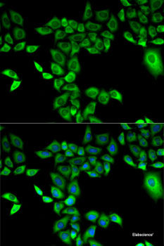 Immunofluorescence analysis of MCF-7 cells using FANCD2 Polyclonal Antibody