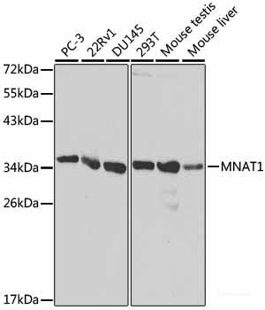 Immunohistochemistry of paraffin-embedded Mouse liver using HNF4A Polyclonal Antibody at dilution of 1:100 (40x lens).