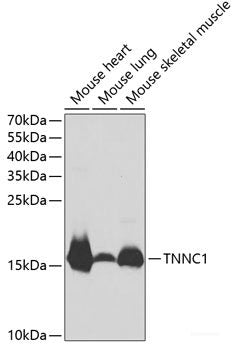 Immunohistochemistry of paraffin-embedded Rat pancreatic islet using INS Polyclonal Antibody at dilution of 1:50 (40x lens).