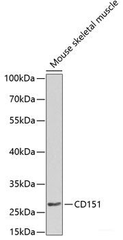 Western blot analysis of extracts of various cell lines using LCN2 Polyclonal Antibody at dilution of 1:3000.