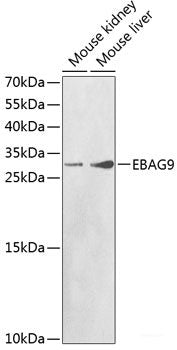 Immunohistochemistry of paraffin-embedded Mouse stomach using NTRK1 Polyclonal Antibody at dilution of 1:100 (40x lens).