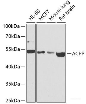 Immunohistochemistry of paraffin-embedded Rat lung using REG3A Polyclonal Antibody at dilution of 1:100 (40x lens).