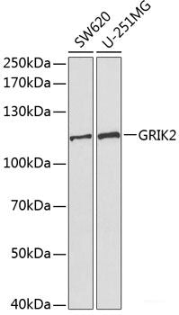 Immunohistochemistry of paraffin-embedded Rat brain using PDE1B Polyclonal Antibody at dilution of 1:100 (40x lens).