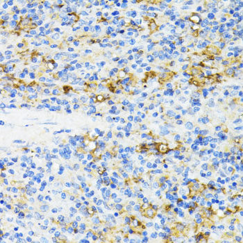 Immunohistochemistry of paraffin-embedded Rat spleen using PRKCE Polyclonal Antibody at dilution of 1:200 (40x lens).