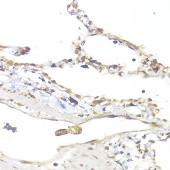 Immunohistochemistry of paraffin-embedded Rat brain using PTEN Polyclonal Antibody at dilution of 1:200 (40x lens).