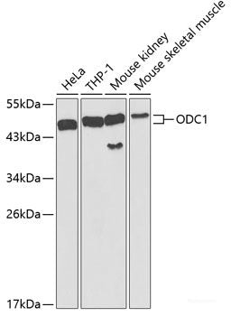 Immunohistochemistry of paraffin-embedded Human esophagus using FAK Polyclonal Antibody at dilution of 1:100 (40x lens).