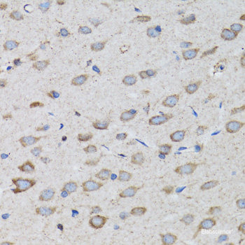 Western blot analysis of extracts of Mouse thymus using PTPRC Polyclonal Antibody at dilution of 1:1000.