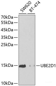 Immunofluorescence analysis of Y79 cells using Rb Polyclonal Antibody at dilution of 1:100. Blue: DAPI for nuclear staining.