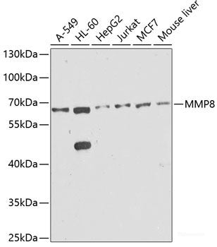 Immunofluorescence analysis of Mouse brain cells using THY1 Polyclonal Antibody at dilution of 1:100. Blue: DAPI for nuclear staining.