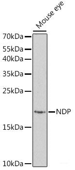 Western blot analysis of extracts of various cell lines using SUMO1 Polyclonal Antibody at dilution of 1:1000.