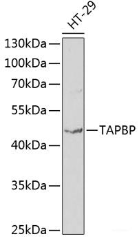 Western blot analysis of extracts of HL-60 cells using XRCC3 Polyclonal Antibody at dilution of 1:1000.