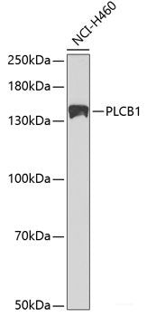 Immunohistochemistry of paraffin-embedded Human colon carcinoma using TNFSF10 Polyclonal Antibody at dilution of 1:200 (40x lens).