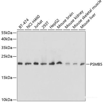 Immunofluorescence analysis of U2OS cells using NDRG1 Polyclonal Antibody