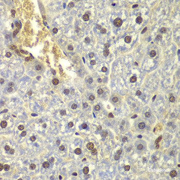 Immunofluorescence analysis of C6 cells using MALT1 Polyclonal Antibody at dilution of 1:100. Blue: DAPI for nuclear staining.