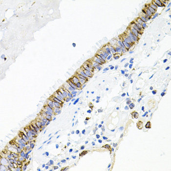 Western blot analysis of extracts of various cell lines using LETMD1 Polyclonal Antibody at dilution of 1:1000.