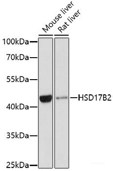 Western blot analysis of extracts of Mouse testis using EPPIN Polyclonal Antibody at dilution of 1:1000.