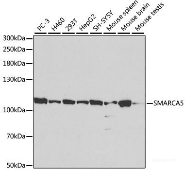 Immunohistochemistry of paraffin-embedded Human tonsil using ALOX5 Polyclonal Antibody at dilution of 1:100 (40x lens).