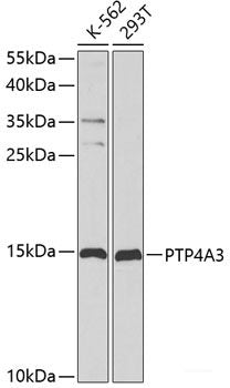 Immunohistochemistry of paraffin-embedded Human liver cancer using CYP2E1 Polyclonal Antibody at dilution of 1:100 (40x lens).