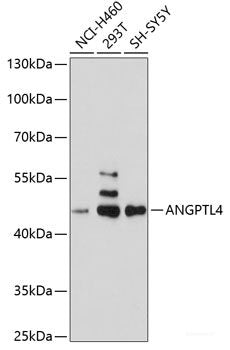 Western blot analysis of extracts of various cell lines using HLA-A Polyclonal Antibody at dilution of 1:1000.