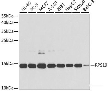 Immunohistochemistry of paraffin-embedded Rat lung using CD18 Polyclonal Antibody at dilution of 1:100 (40x lens).