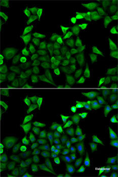 Western blot analysis of extracts of various cell lines using KCNQ1 Polyclonal Antibody at dilution of 1:1000.