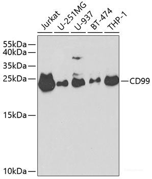 Western blot analysis of extracts of Mouse pancreas using BNP Polyclonal Antibody at dilution of 1:1000.