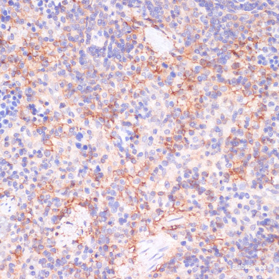 Immunohistochemistry of paraffin-embedded Rat lung using PDGFR beta Polyclonal Antibody at dilution of 1:100 (40x lens).