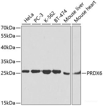Western blot analysis of extracts of various cell lines using PPP2R2A Polyclonal Antibody at dilution of 1:1000.