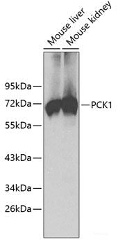 Western blot analysis of extracts of various cell lines using PSMA6 Polyclonal Antibody at dilution of 1:1000.