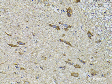 Western blot analysis of extracts of Mouse kidney using VDR Polyclonal Antibody at dilution of 1:1000.