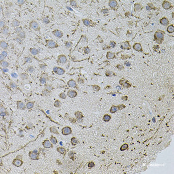 Immunofluorescence analysis of U2OS cells using DLGAP5 Polyclonal Antibody