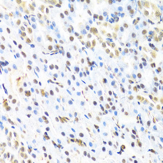 Immunohistochemistry of paraffin-embedded Rat testis using MRP4 / ABCC4 Polyclonal Antibody at dilution of 1:150 (40x lens).