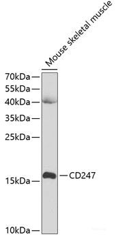Western blot analysis of extracts of various cell lines using TOLLIP Polyclonal Antibody at dilution of 1:1000.