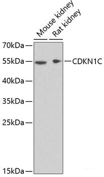 Western blot analysis of extracts of various cell lines using CKMT2 Polyclonal Antibody at dilution of 1:1000.