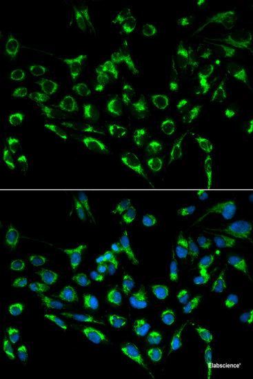 Immunofluorescence analysis of U-2 OS cells using MYST1 Polyclonal Antibody at dilution of 1:100 (40x lens). Blue: DAPI for nuclear staining.