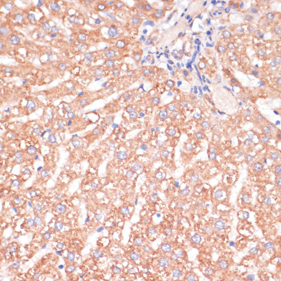 Immunofluorescence analysis of C6 cells using CUX1 Polyclonal Antibody at dilution of 1:100. Blue: DAPI for nuclear staining.