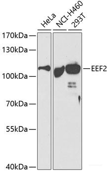 Western blot analysis of extracts of various cell lines using CHD3 Polyclonal Antibody at dilution of 1:1000.