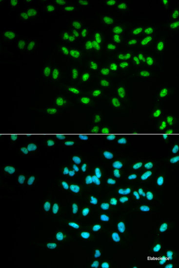 Western blot analysis of extracts of various cell lines using MTA2 Polyclonal Antibody.