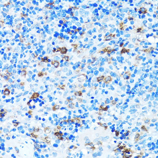 Western blot analysis of extracts of OVCAR-3 cells using CBX1 Polyclonal Antibody at dilution of 1:1000.