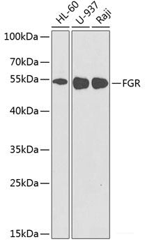 Western blot analysis of extracts of various cell lines using CBX3 Polyclonal Antibody at dilution of 1:1000.