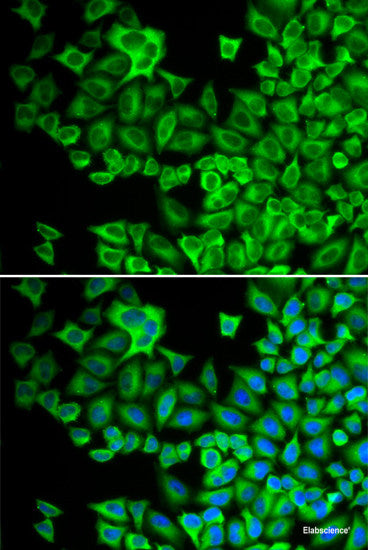 Immunohistochemistry of paraffin-embedded Rat lung using LEPREL2 Polyclonal Antibody at dilution of 1:200 (40x lens).