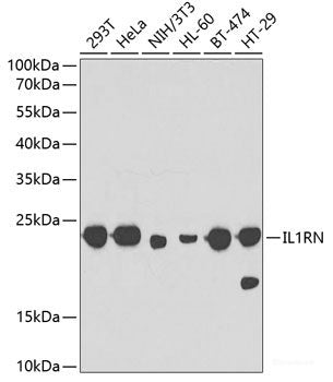 Western blot analysis of extracts of A-549 cells using MTA3 Polyclonal Antibody at dilution of 1:1000.