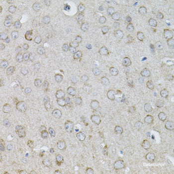 Immunohistochemistry of paraffin-embedded Rat testis using DNMT3L Polyclonal Antibody at dilution of 1:100 (40x lens).