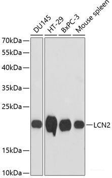 Immunohistochemistry of paraffin-embedded Human breast using HAUSP / USP7 Polyclonal Antibody at dilution of 1:100 (40x lens).