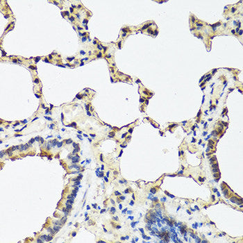 Western blot analysis of extracts of various cell lines using MonoMethyl-Histone H3-K4 Polyclonal Antibody.