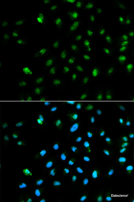 Western blot analysis of extracts of various cell lines using DiMethyl-Histone H3-K9 Polyclonal Antibody.
