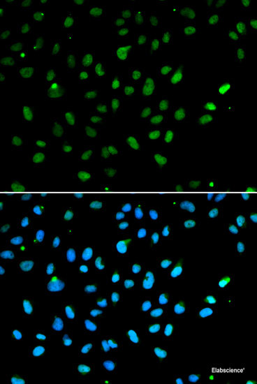 Western blot analysis of extracts of various cell lines using MonoMethyl-Histone H3-K79 Polyclonal Antibody.