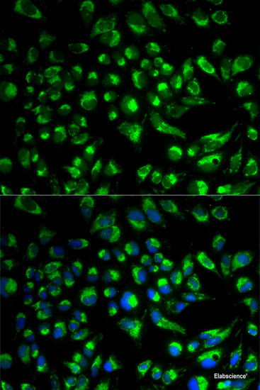 Western blot analysis of extracts of various cell lines using DiMethyl-Histone H3-K79 Polyclonal Antibody.